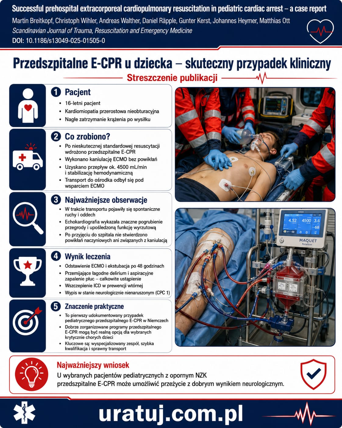 ECMO - aktualne doniesienia naukowe, wskazania, rola ratownika medycznego - obrazek 3
