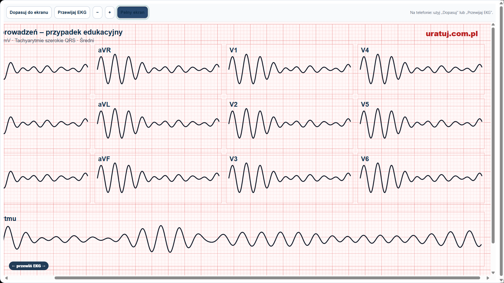 Szkolenie ustawiczne w zawodach medycznych - kurs internetowy EKG - obrazek 6